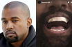 Kanye West file photo and his latest titanium teeth inspired from James Bond character Jaw